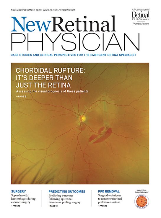 Retinal Physician